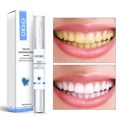 Blanqueador Dental Premium® - MySmile